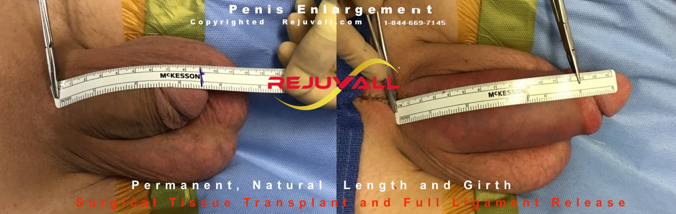Penis jelqing before and after