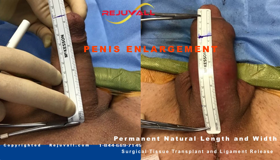 Natural Penis Enlargement And Lengthening acsfloralandevents. gotchamall.co...