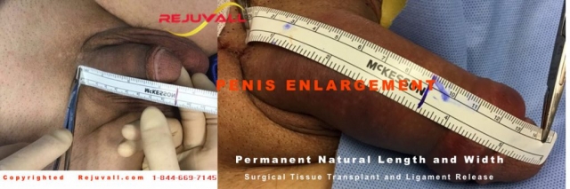 male enhancement before after pics