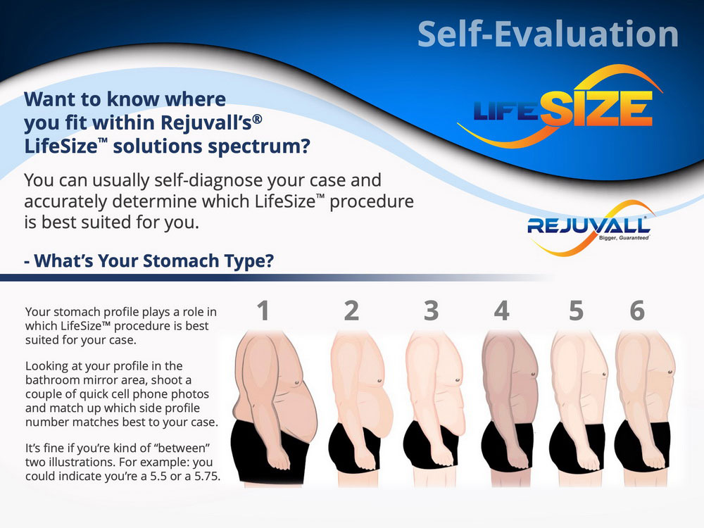 Increase apparent penile length by cryolipolysis in the reduction