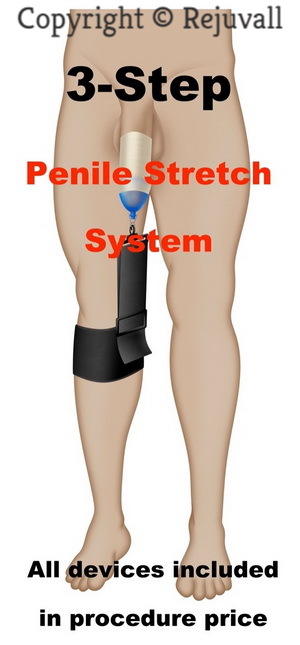 Stretch penis device post surgery