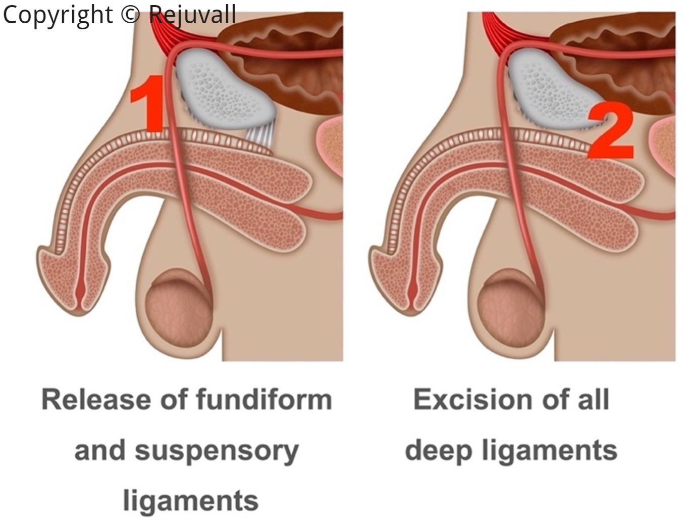 Men’s stomach contouring penile growth