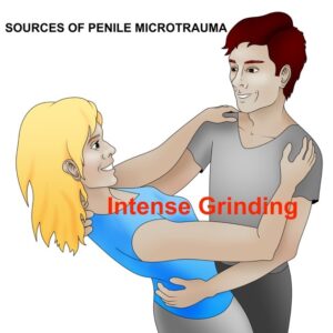 intense grinding penile injured