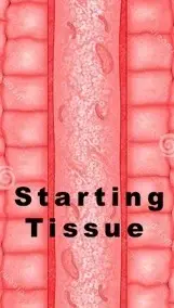 penile tissue before enhancement