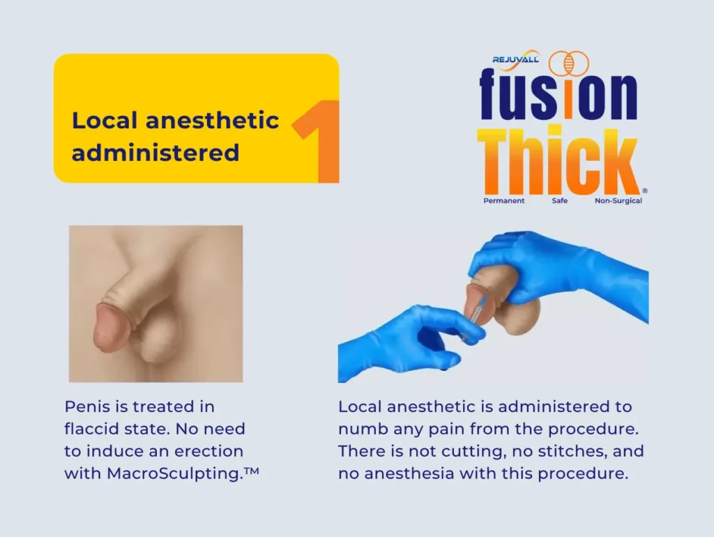 FusionThick stepwise plan diagram: HA foundation followed by permanent underlayer planning