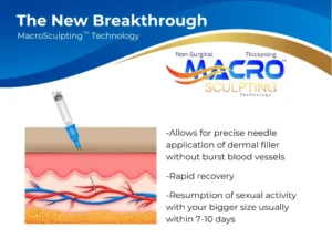 MacroSculpting penile filler injection for natural-looking girth enhancement