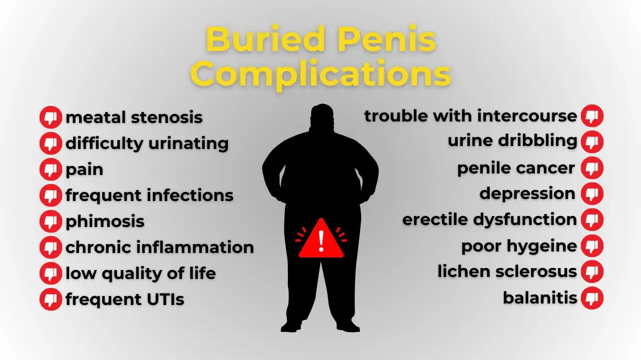 infographic with list of complications from buried penis shows silhouette of an obese man in middle with a red warning sign over his pelvis