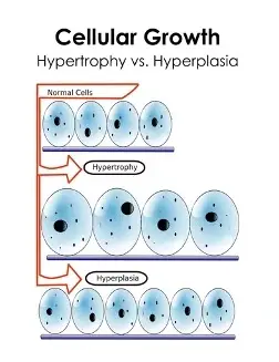 medical illustration showing the different types of cellular growth