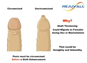 medical illustrations of a circumcised penis next to an uncircumcised penis with labels explaining why it's better to girth enhance a circumcised penis than uncircumcised