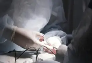 Closeup of a penis enlargement surgery being performed