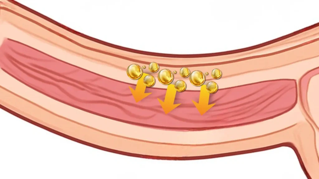 Illustration showing how deep PMMA penile filler placement can compress important penile structures