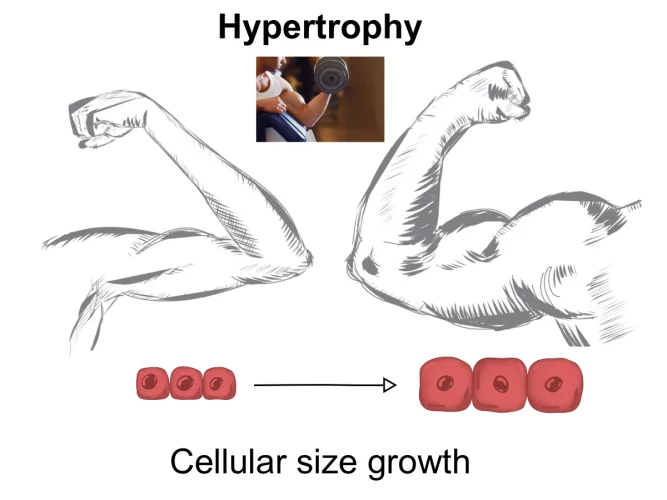before and after hypertrophy